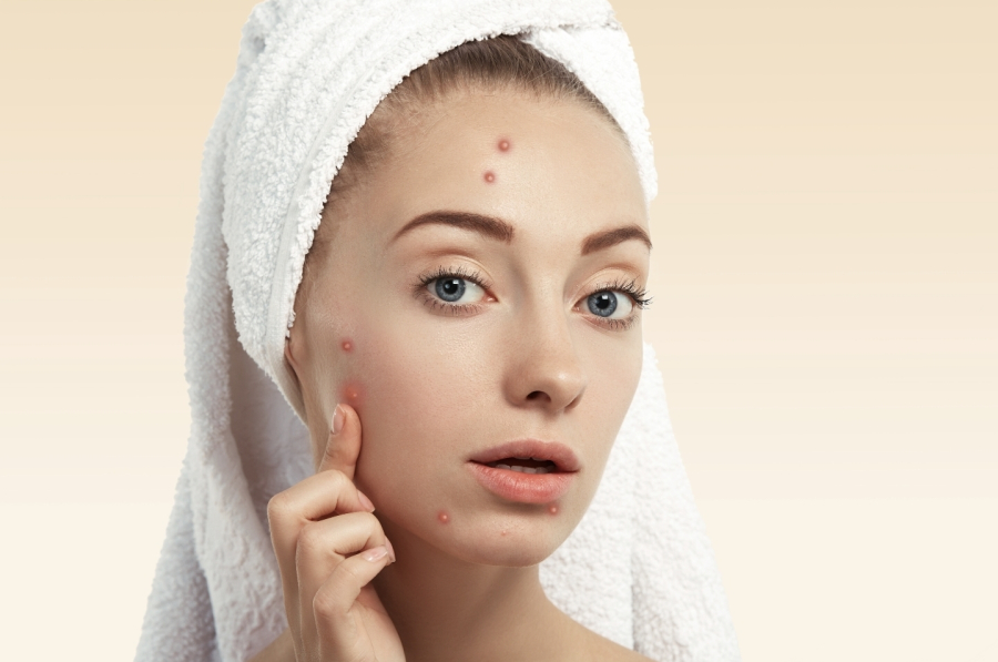 Lesão que não cicatriza pode ser confundida com acne e acende alerta para câncer de pele