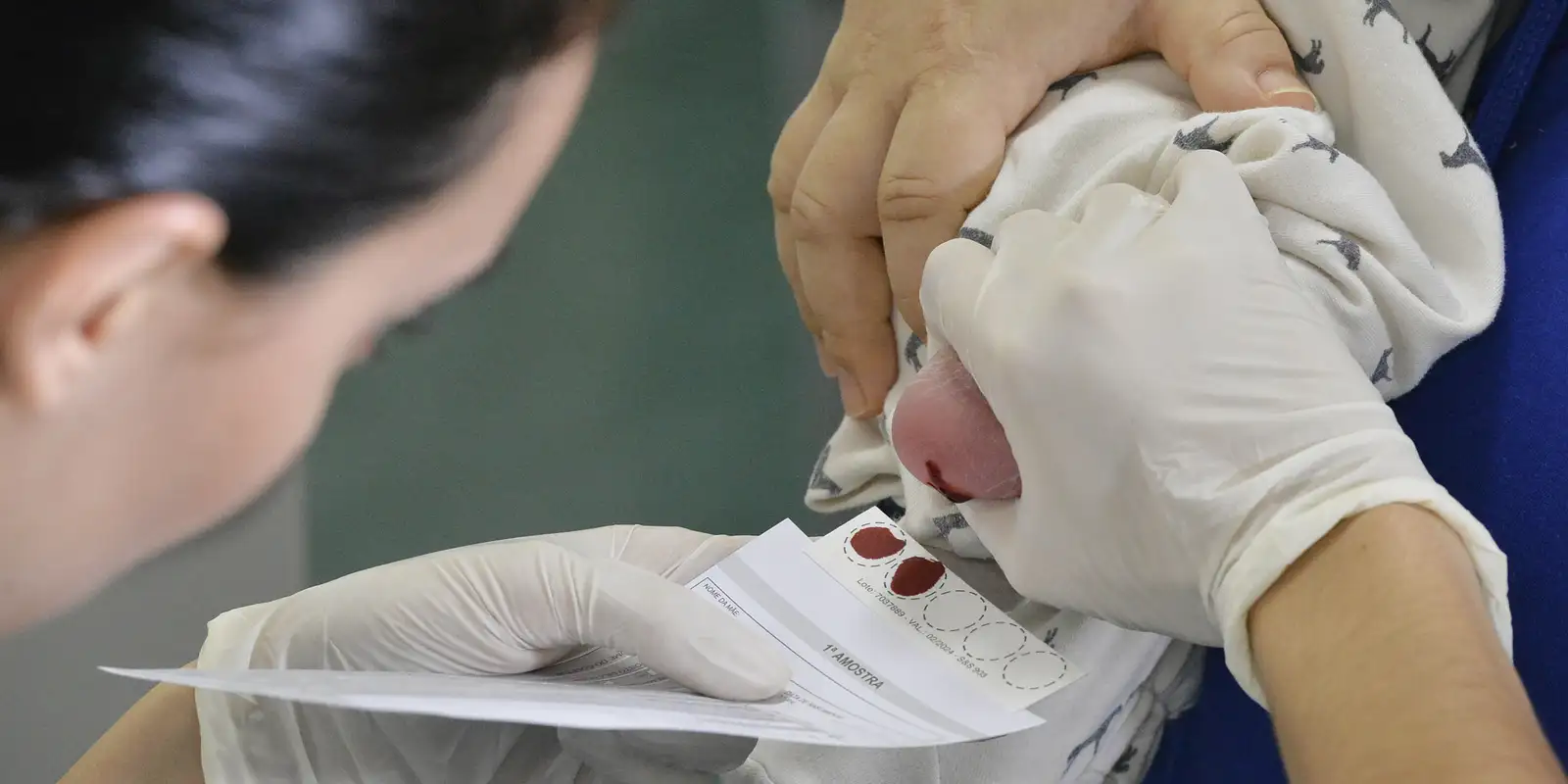 Atraso na ampliação do teste do pezinho dificulta diagnóstico da AME
